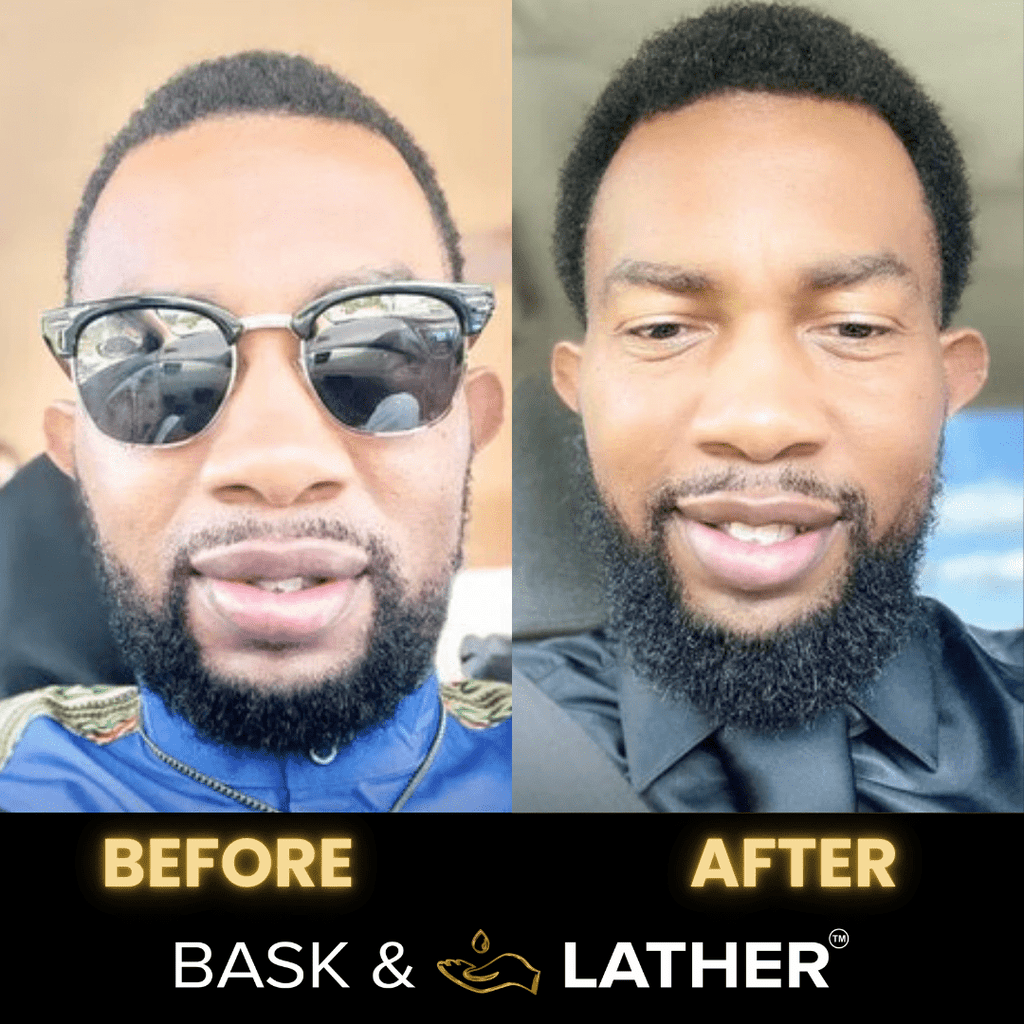 Men?s Healthy Hair and Beard Starter Kit
